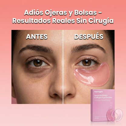Hanregen® InstaLift PDRN & Collagen Patches
